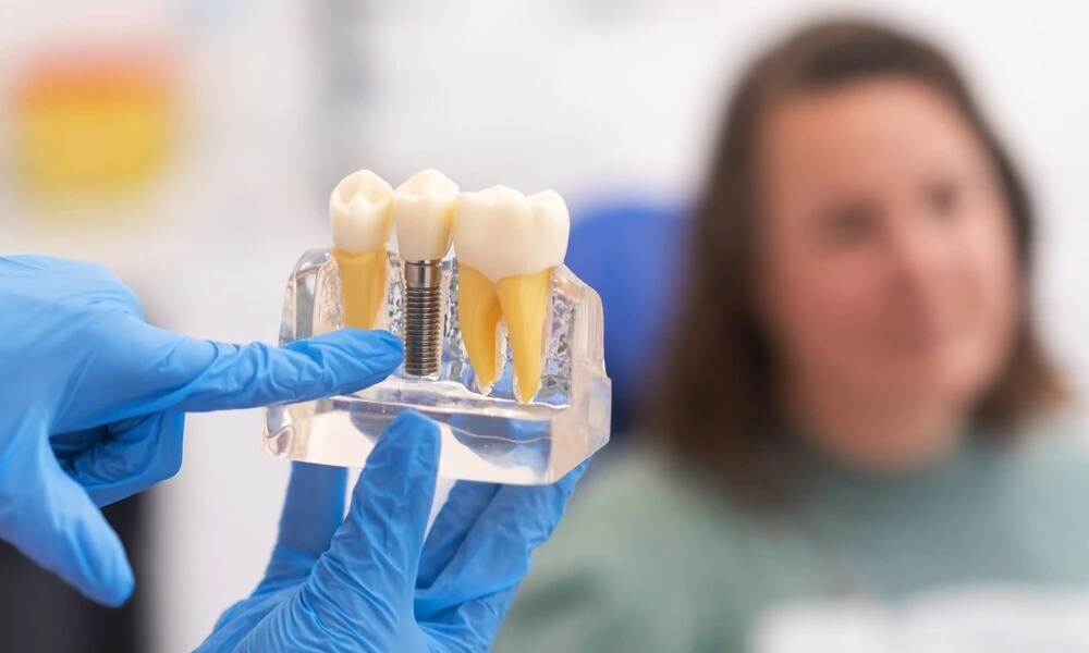 How Gum Specialists Help Maintain Healthy Teeth And Gums